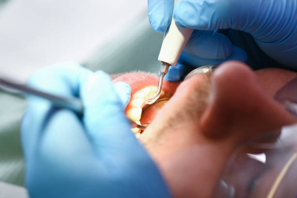 Best Broken or Chipped Tooth Repair in Sun Valley, NV